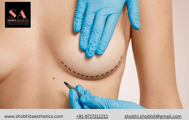 Breast Augmentation in Delhi: Which Implant Shape & Profile Suits Indian Women Most?