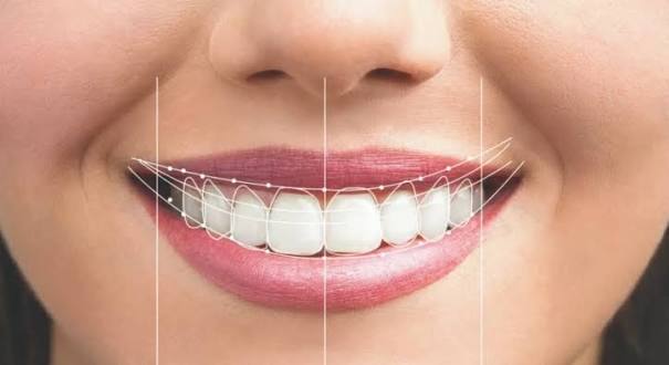 How To Make Smiles Endure With Contemporary Dental Treatments